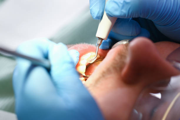 Best Emergency Treatment for Oral Infections in Bayville, NY